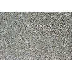 Human Mesenchymal Stem Cells-Bone Marrow (HMSC-bm)